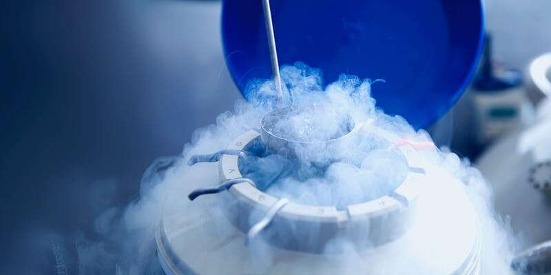 cryogenic storage